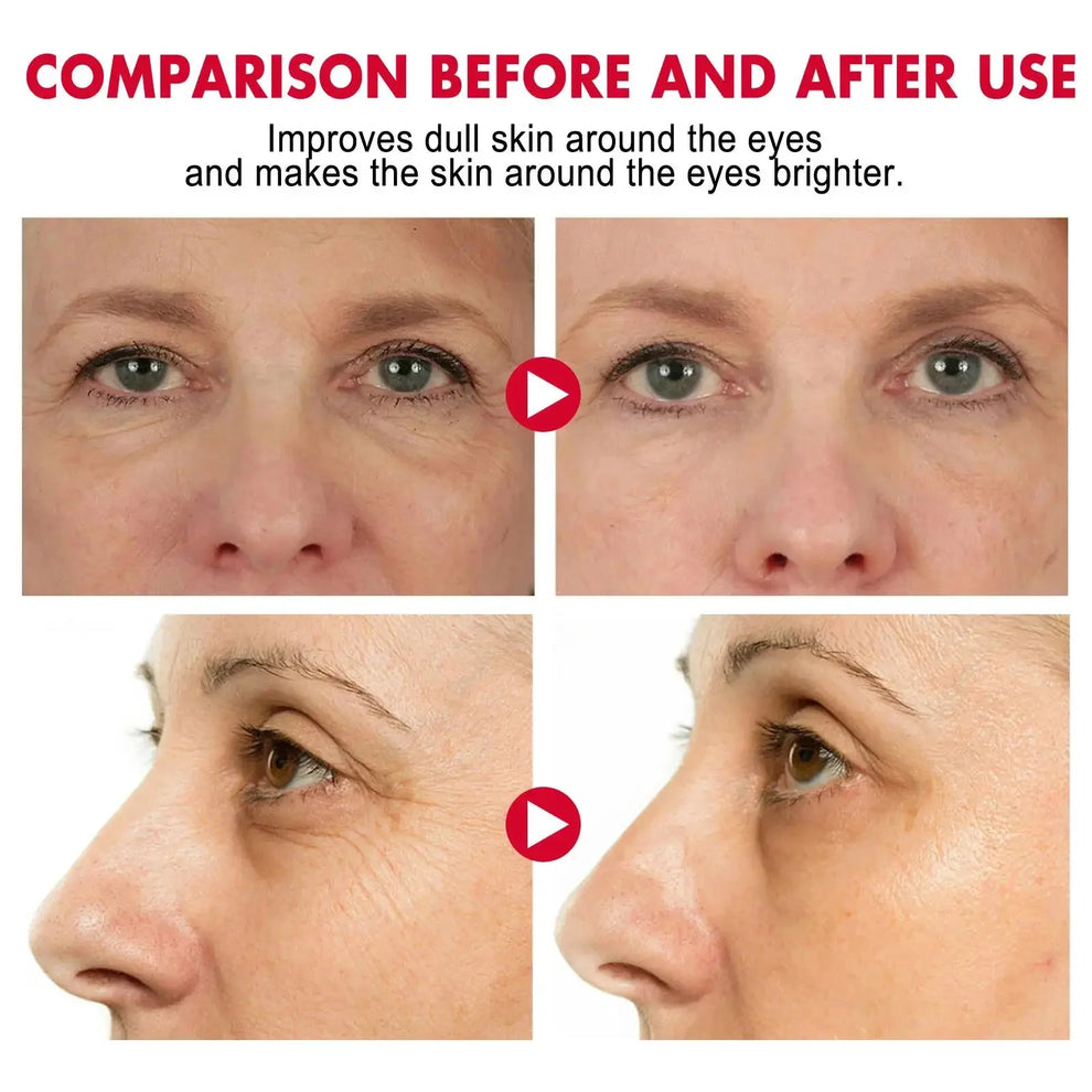 under eye cream - Skincare - Retinol Anti-Aging Eye Cream for Dark Circles