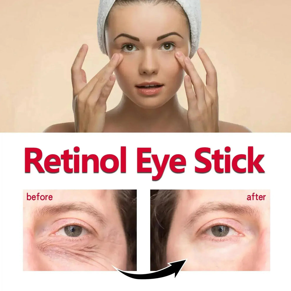skincare - Skincare - Retinol Anti-Aging Eye Cream for Dark Circles