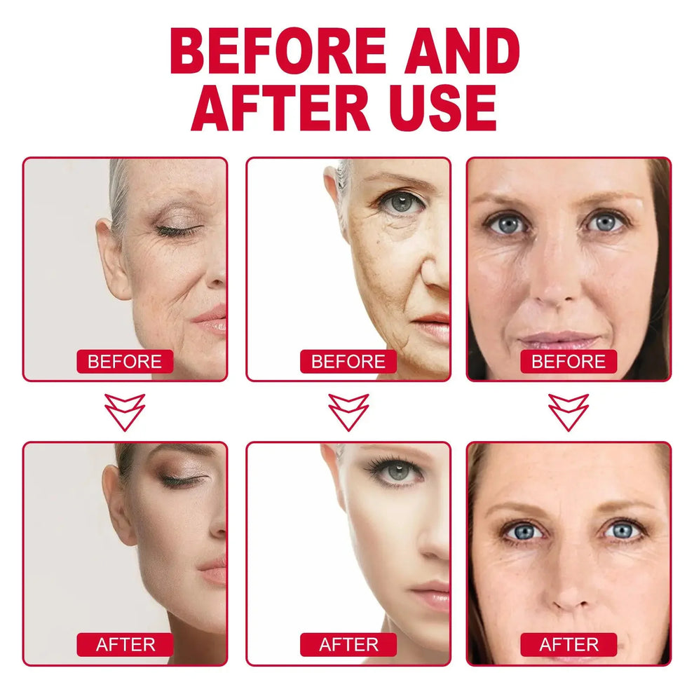 ai personalized eye cream - Skincare - Retinol Anti-Aging Eye Cream for Dark Circles