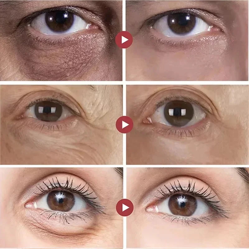 best skin care products - Skincare - Retinol Anti-Aging Eye Cream for Dark Circles