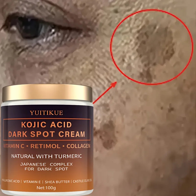 anti aging cream - Skincare - Alpha Arbutin Fading Cream