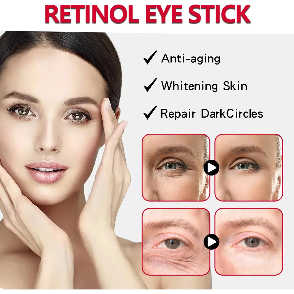 eye cream - Skincare - Retinol Anti-Aging Eye Cream for Dark Circles