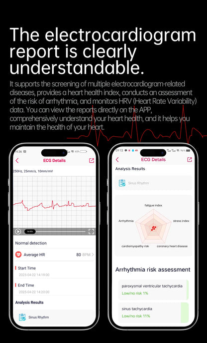 Smartwatch - Smartwatch - watches timepiece