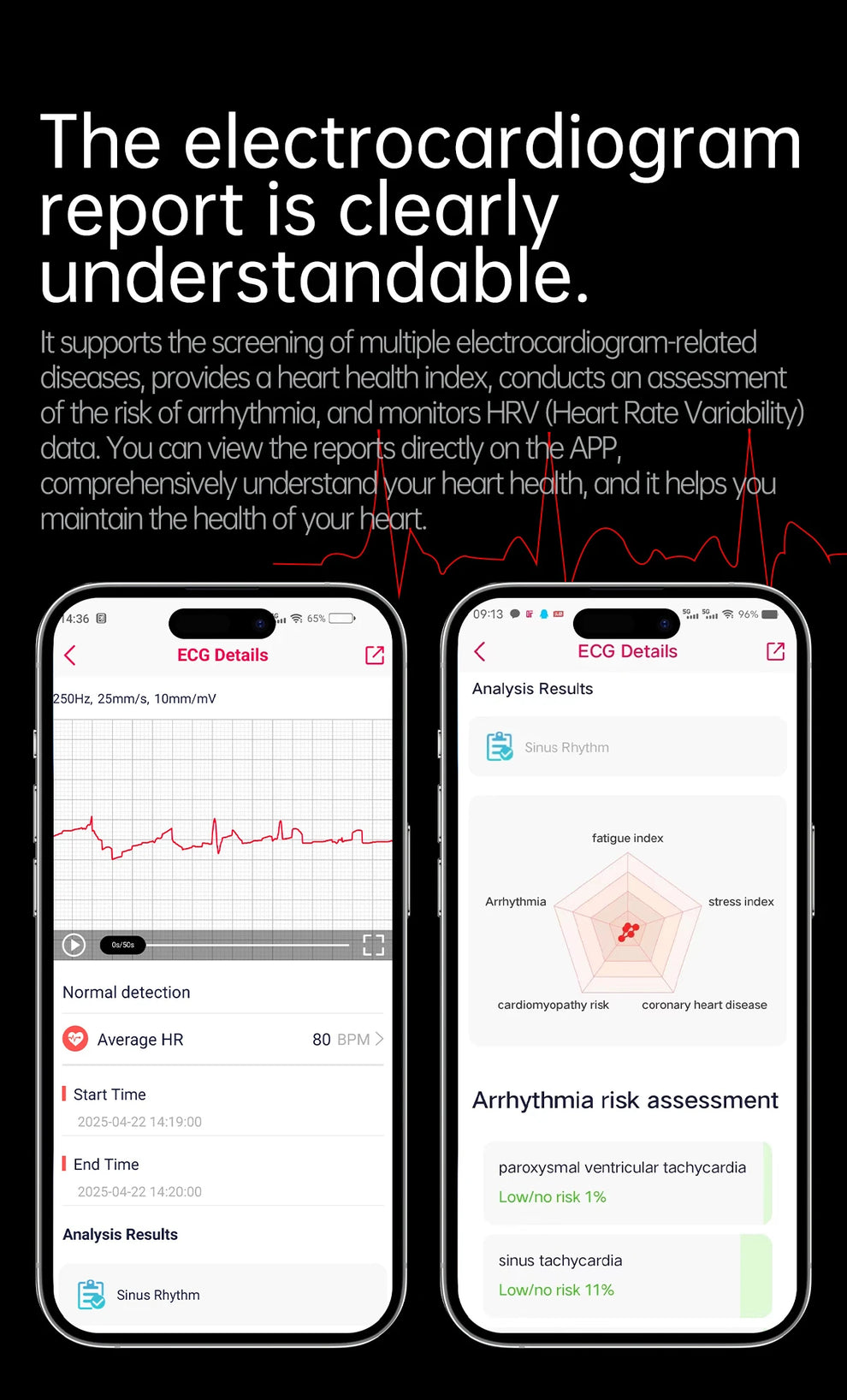 Smartwatch - Smartwatch - watches timepiece