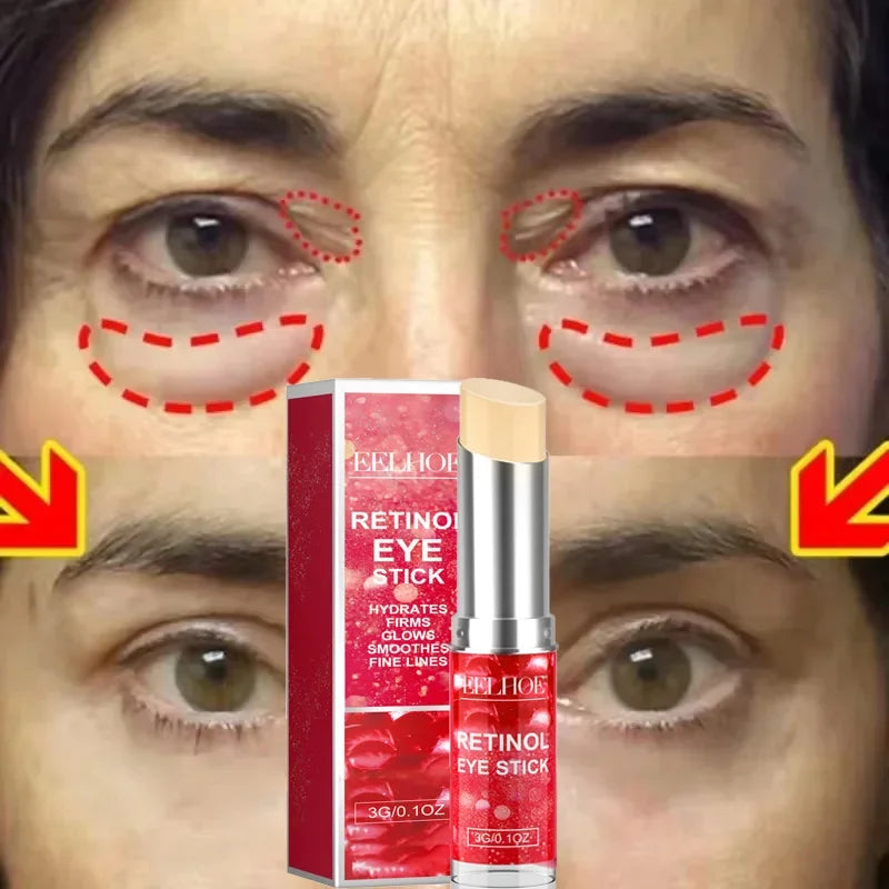 Anti aging eye cream